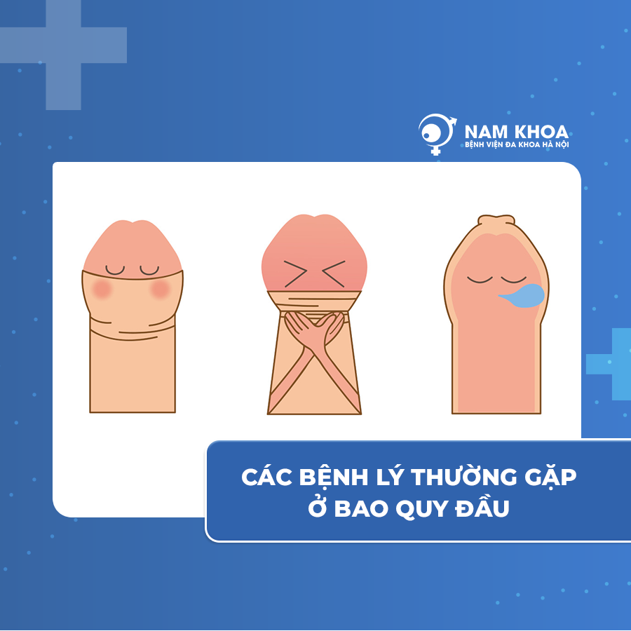 Các Bệnh Lý Thường Gặp Ở Bao Quy Đầu