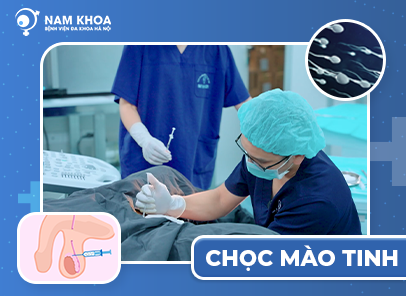 Chọc mào tinh PESA