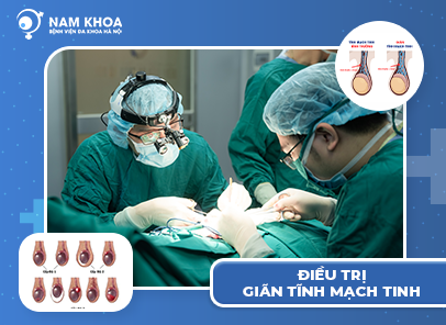 Điều trị giãn tĩnh mạch tinh