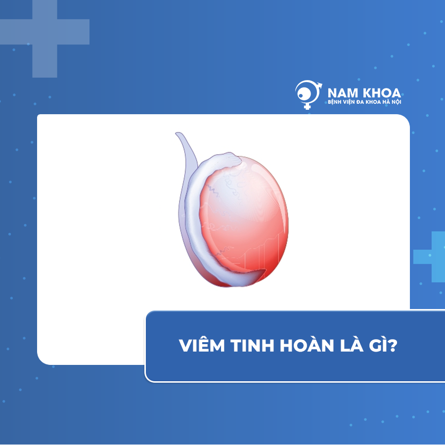 Viêm tinh hoàn là gì?