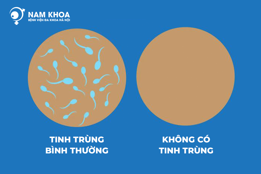 nam giới không có tinh trùng