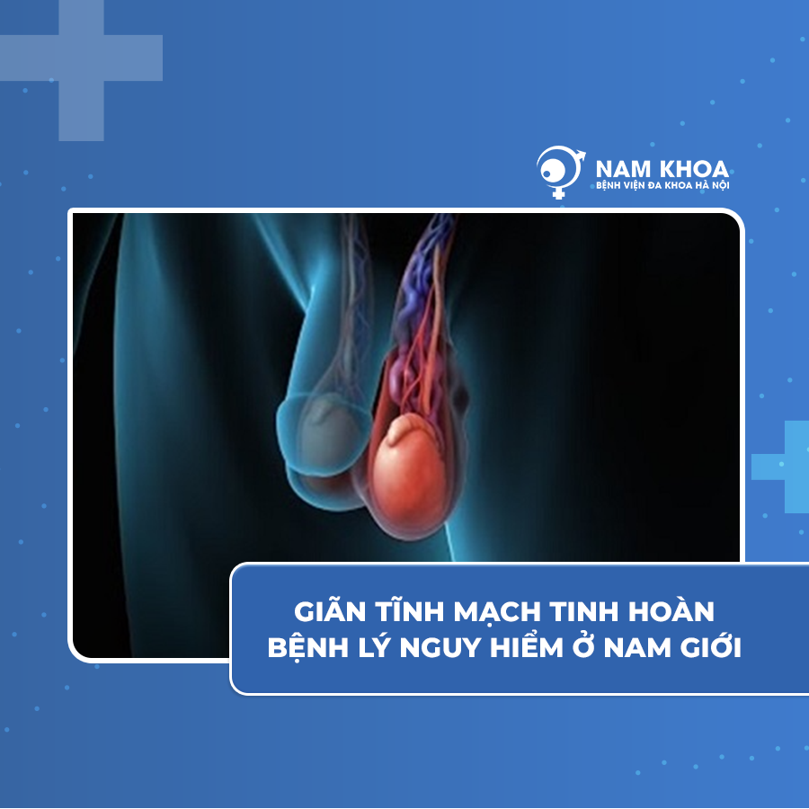 Bệnh giãn tĩnh mạch tinh hoàn có nguy hiểm không?