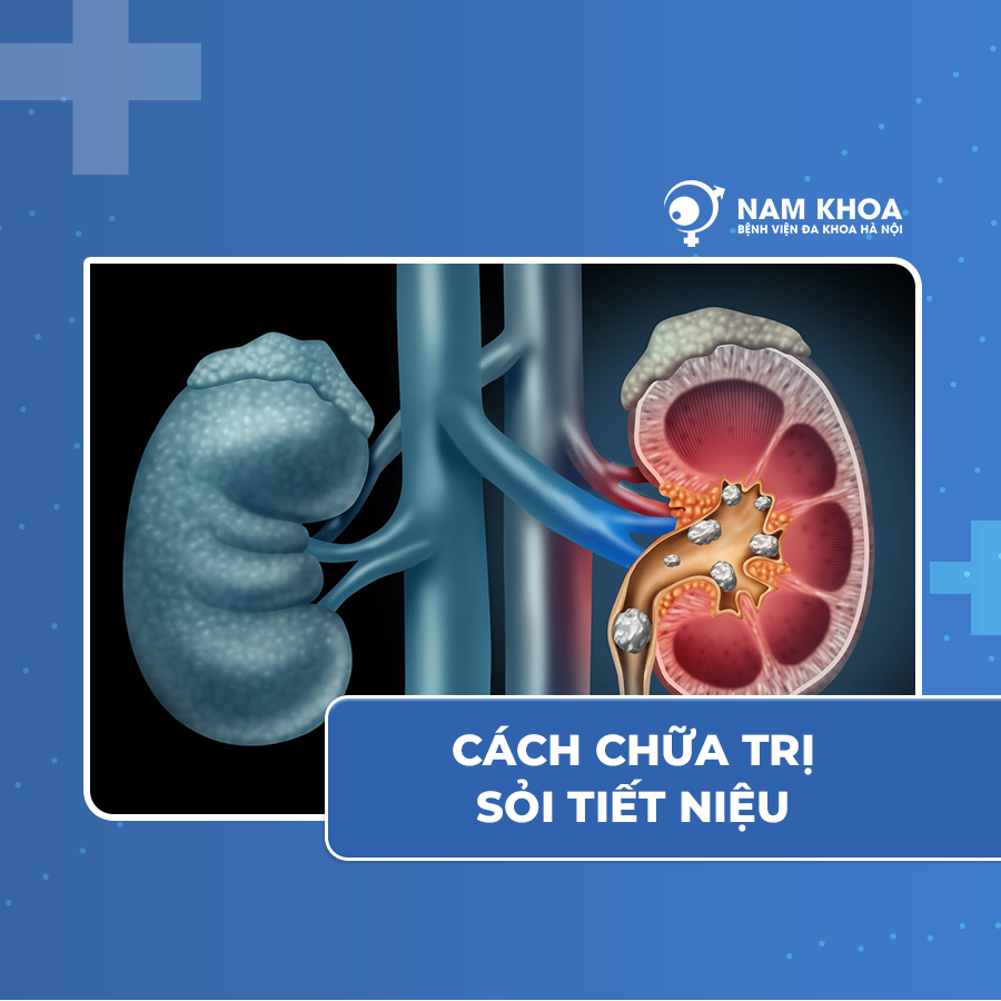 Sỏi tiết niệu là gì? Cách chữa sỏi tiết niệu 