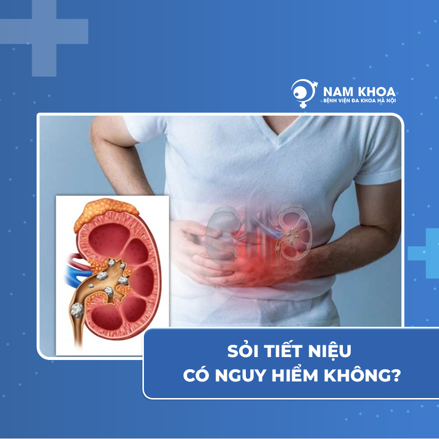 Sỏi tiết niệu có nguy hiểm không?