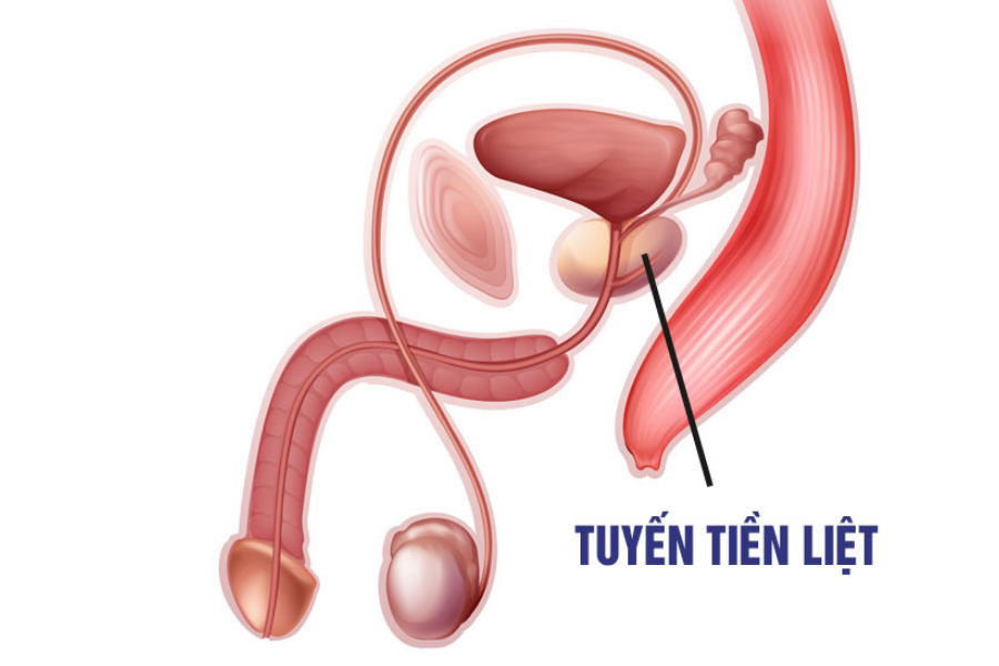 bệnh lý về tuyến tiền liệt